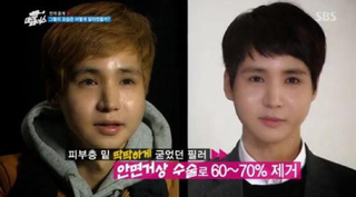 Illustration for article titled Depressing? Inspirational? Reverse Plastic Surgery Show Hits Korea